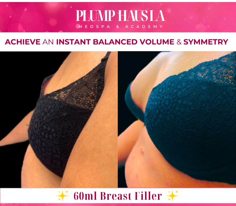 Liquid Breast Filler