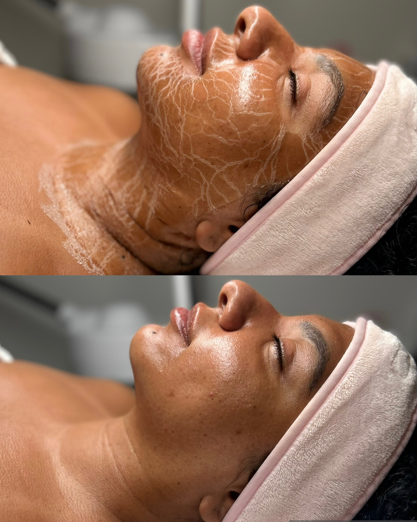 Firming Peptide Facial