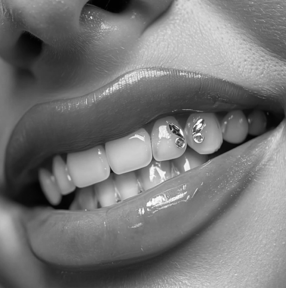 Tooth Gems -2 at StarLuxeSpa in Sacramento, CA