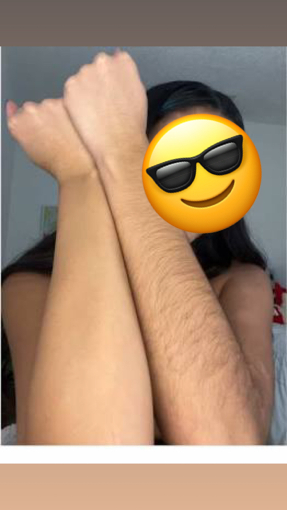 Half Arm Wax at Luxury Smiles, Waxes & More in Dallas, TX