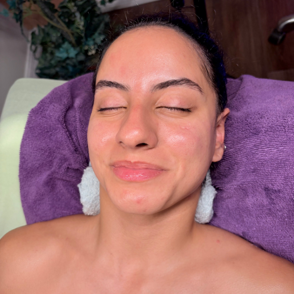 MODEL CALL | Glo² + Dermaplane + RF at The Holistic Glow | Luxury Skincare in Gainesville, FL