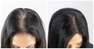 New growth touch up