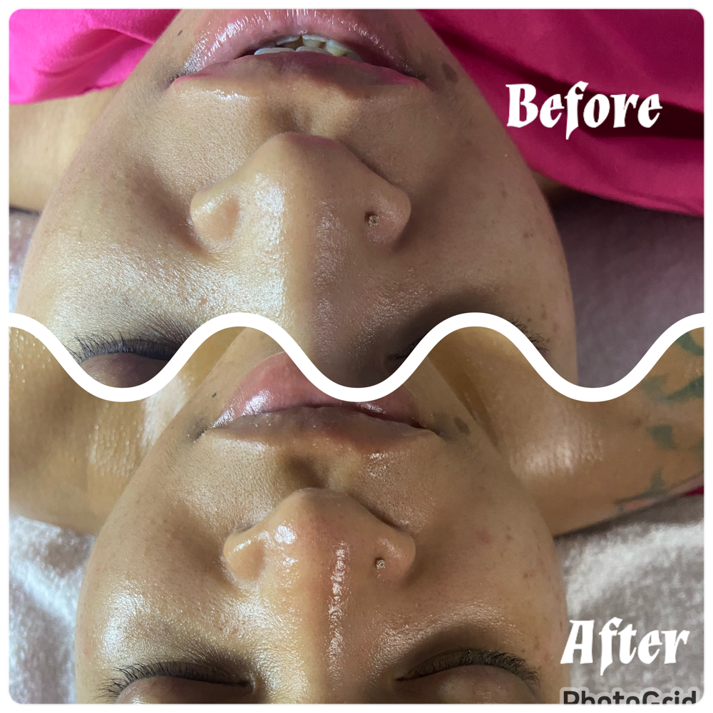 Glow Facial at Glow2Go in Cincinnati, OH