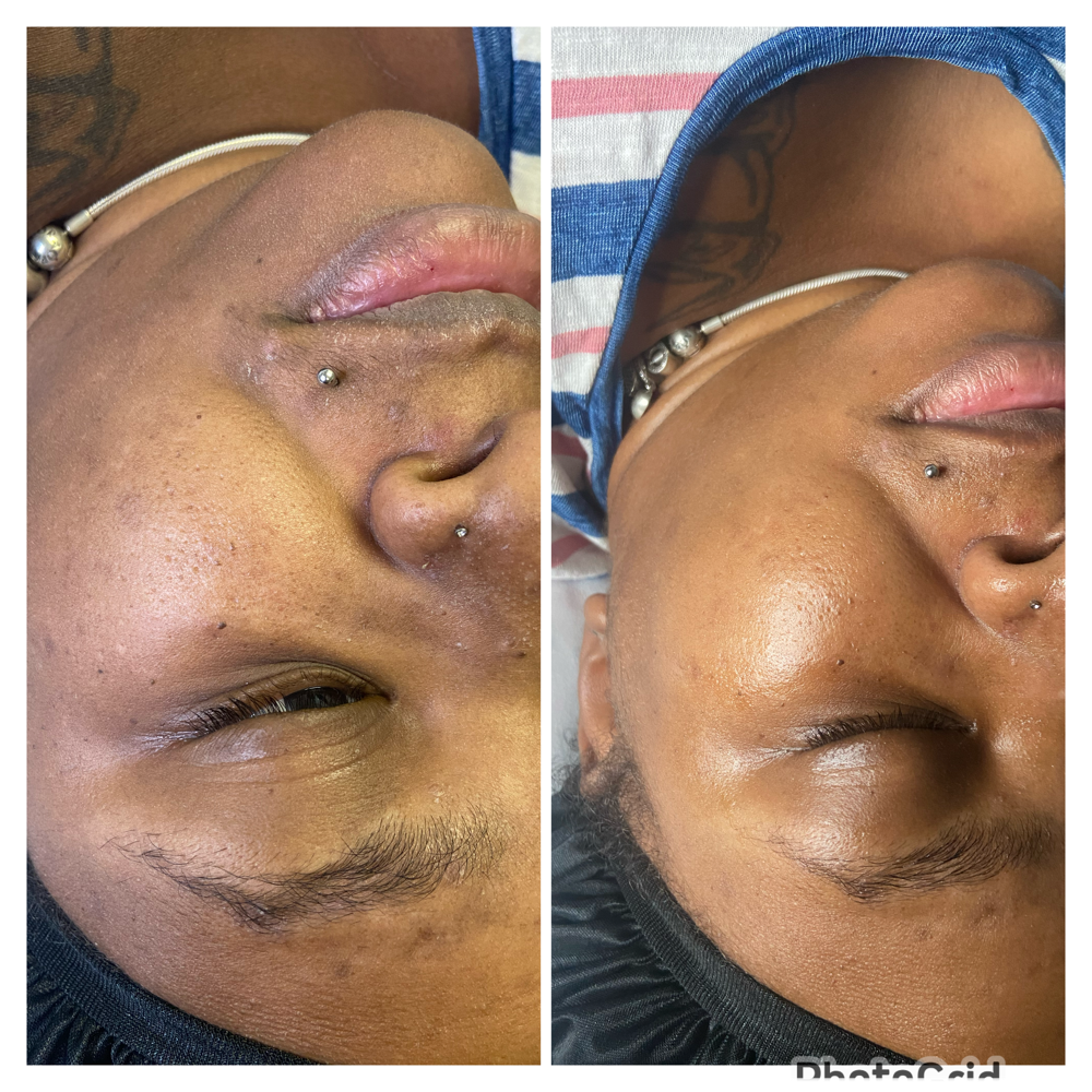 Glow Facial