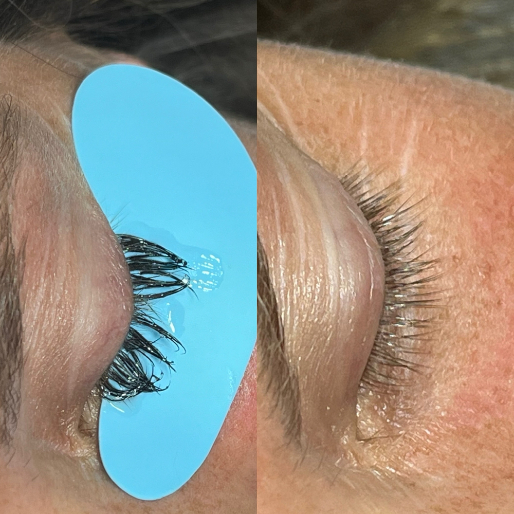 Lash Removal