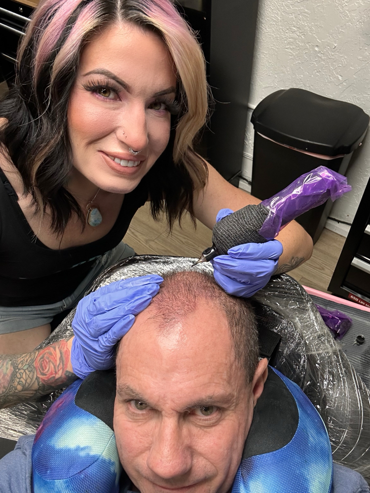 Scalp MicroPigmentation (SMP)