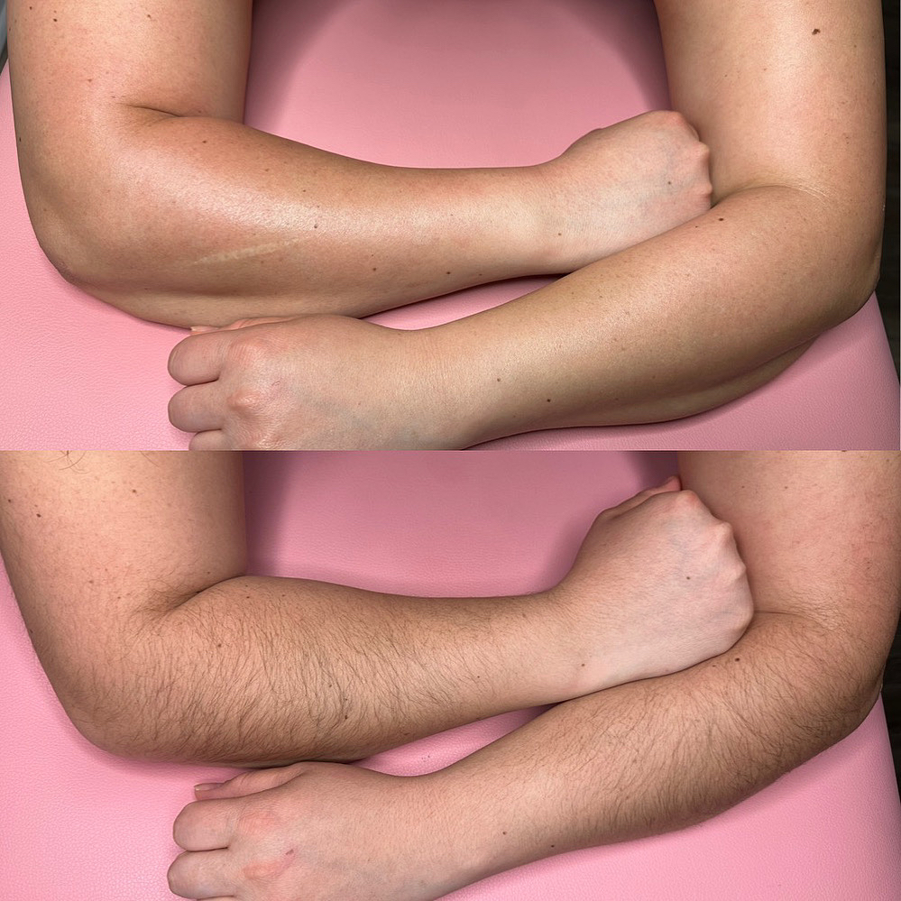 Full Arm Wax