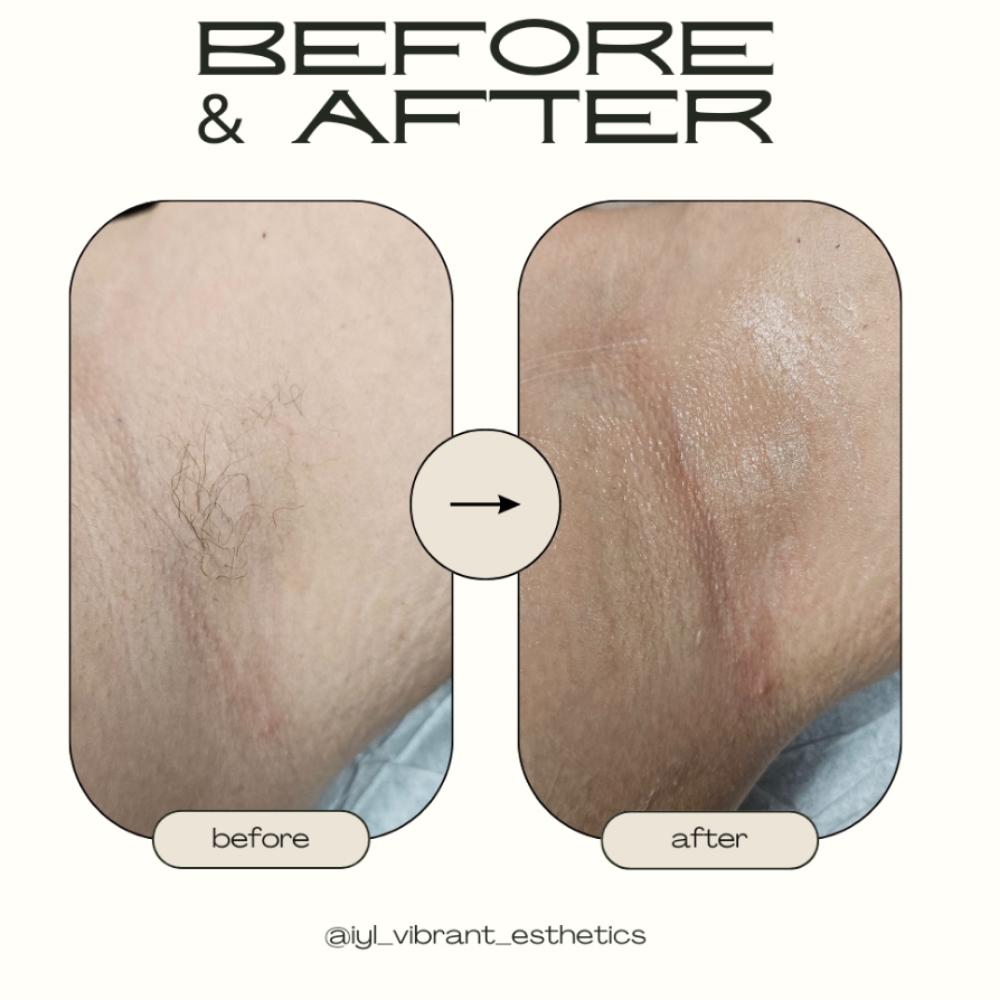 Underarm Wax at IYL VIBRANT SKIN STUDIO in El Paso, TX