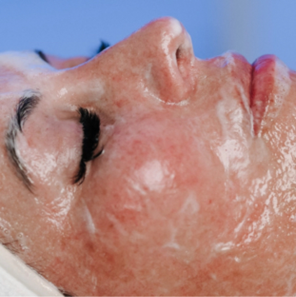 Luxe Lift Facial at Luxe Beauty by Mickie in Ft Worth, TX
