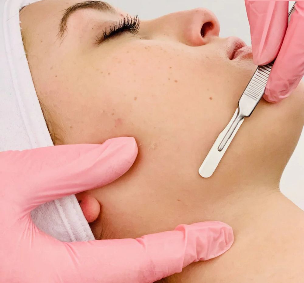 Dermaplaning Facial