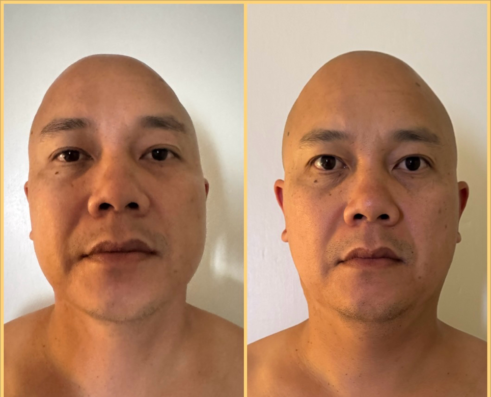 Sculpting Myofascial Massage