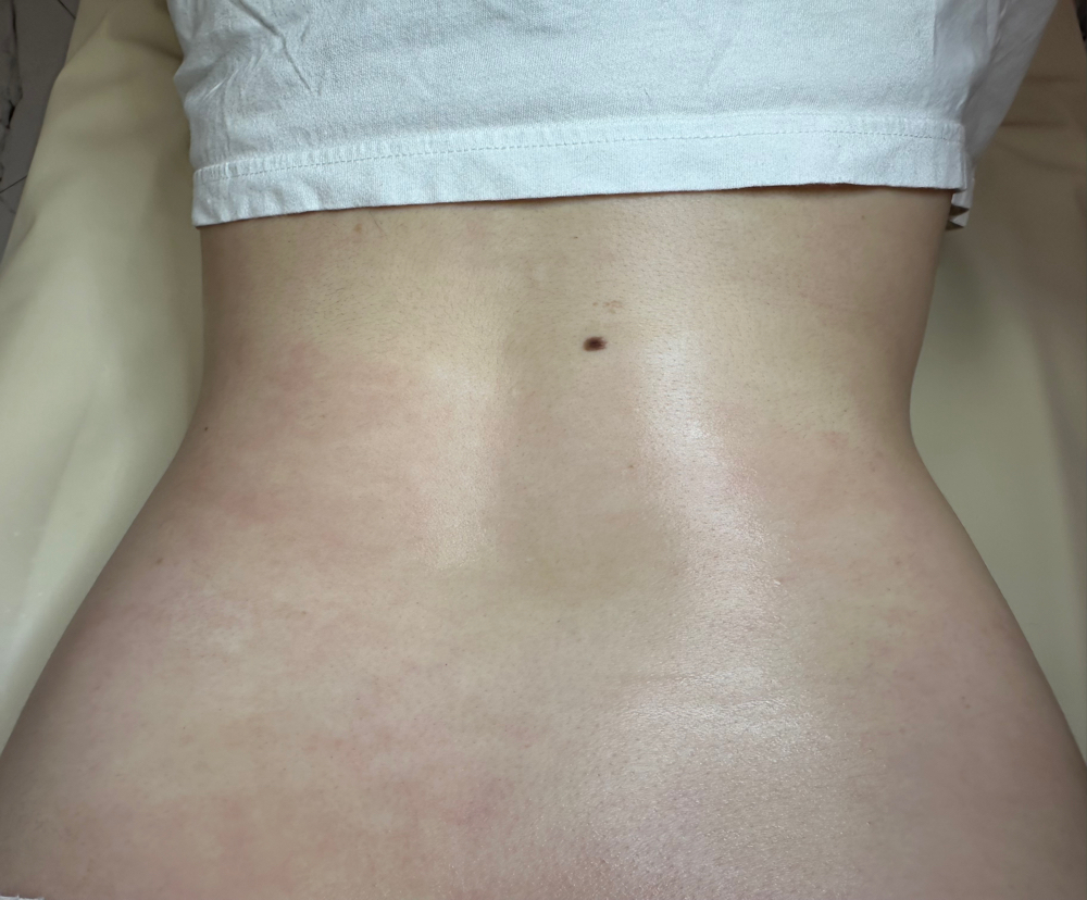 Lower Back