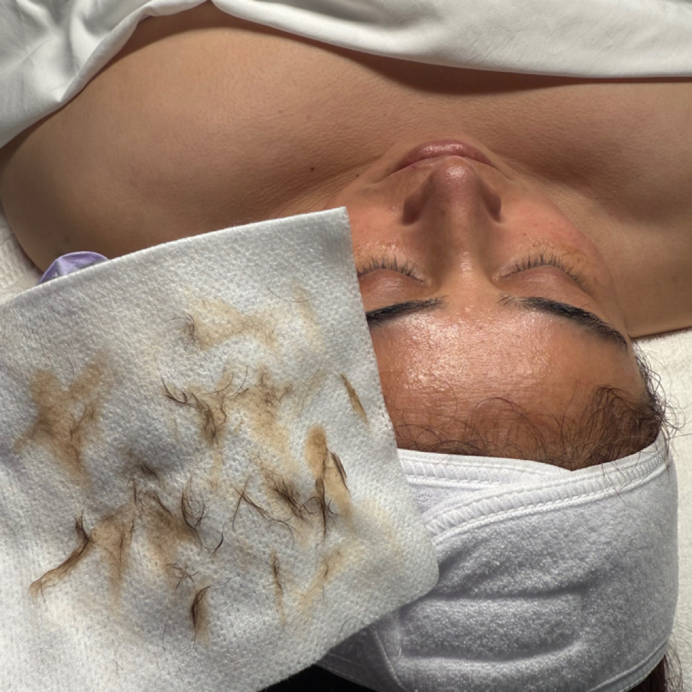 Ultimate Glow-Getter (Dermaplane) at Inclusive Esthetixs in Bakersfield, CA
