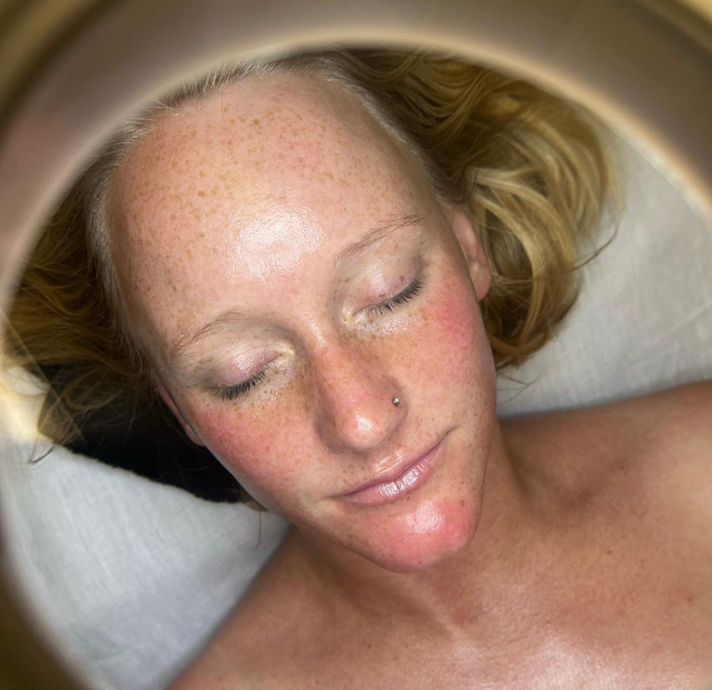 Dermaplane Facial