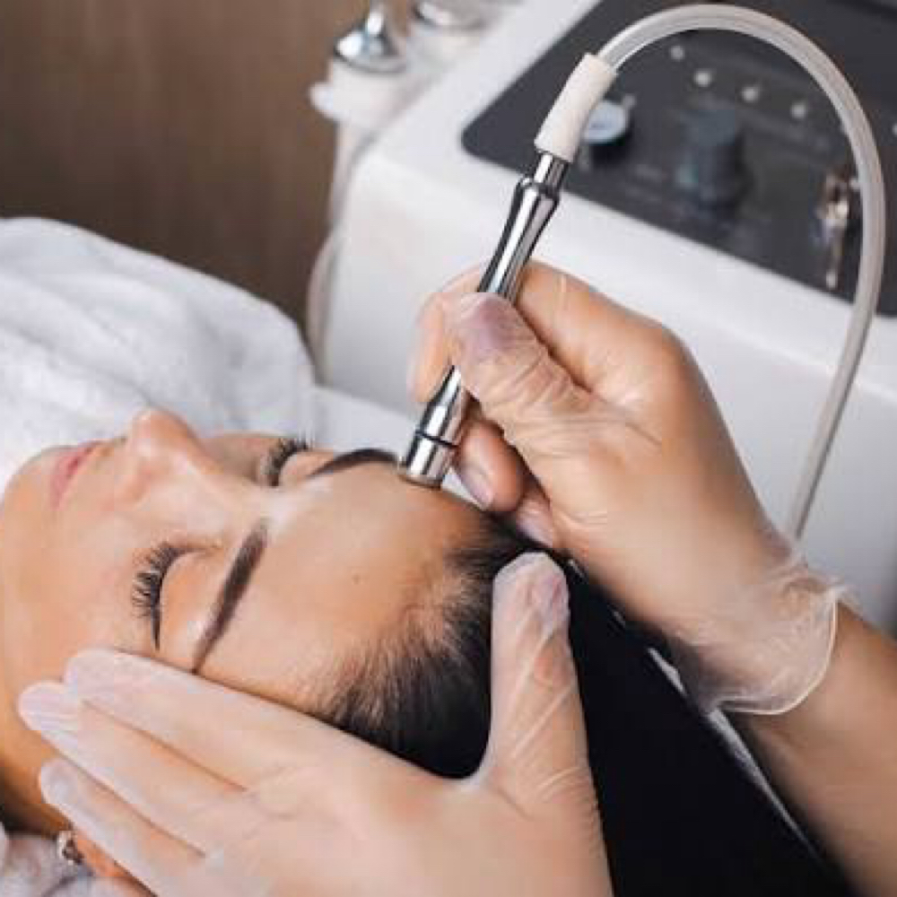 Microdermabrasion