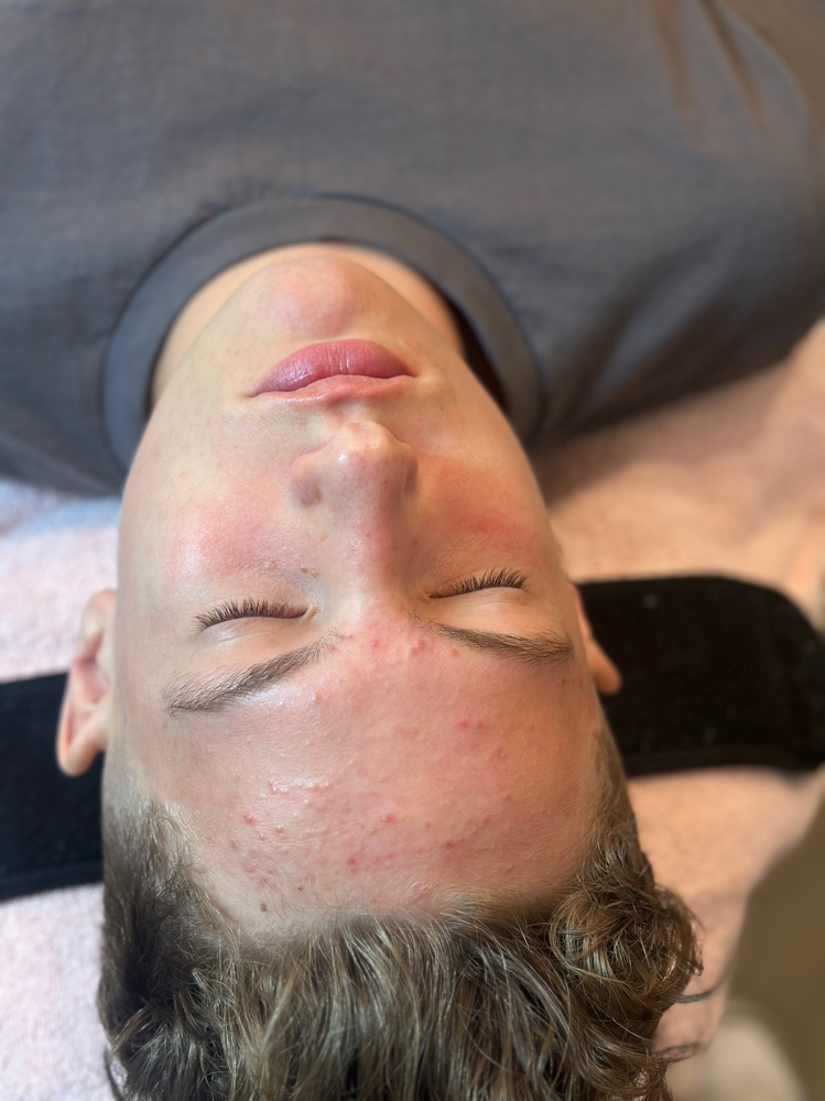 45 Minute Customized Teen Facial