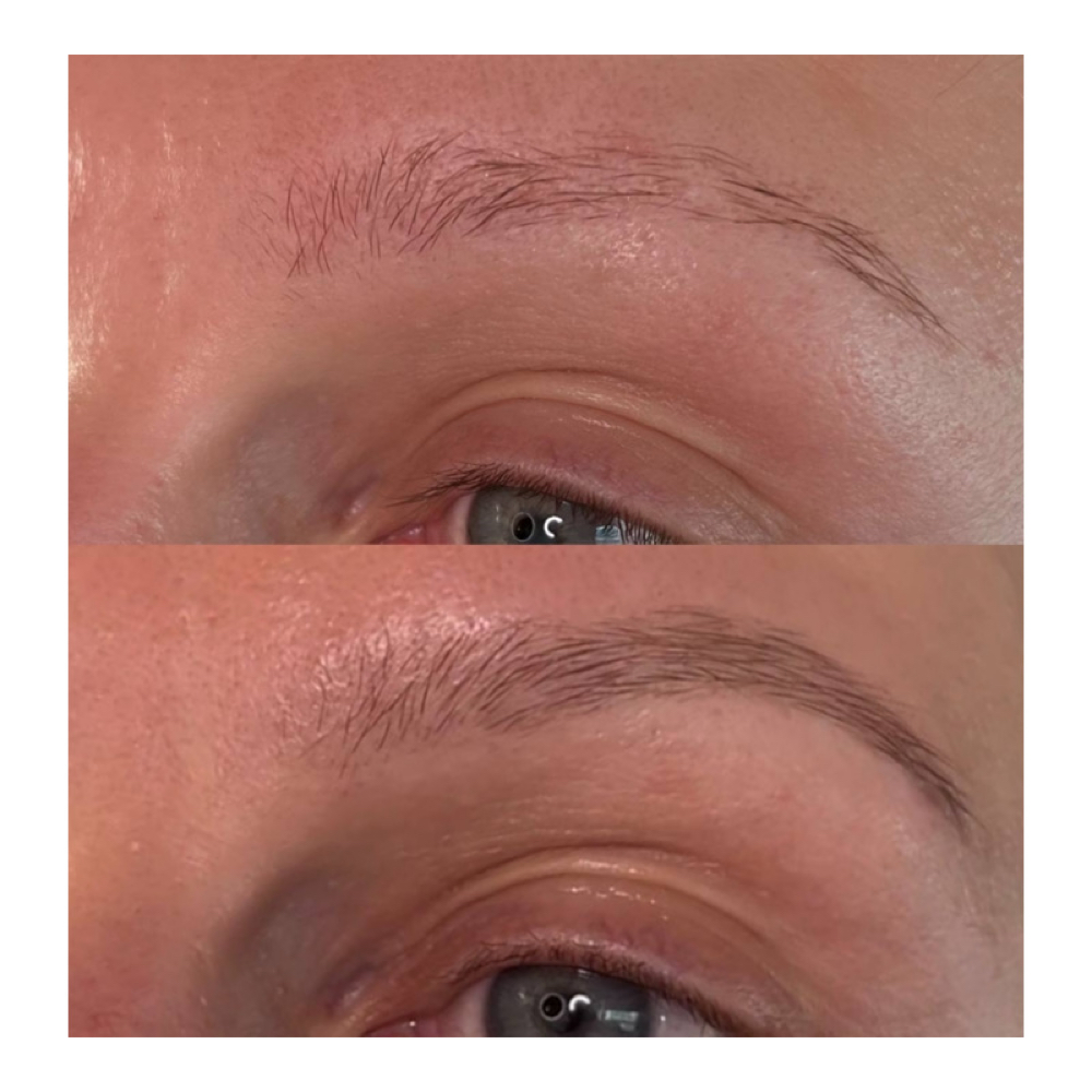 Vitamin Brow Restoration at PureBeauty-Aesthetics in Colorado Springs, CO