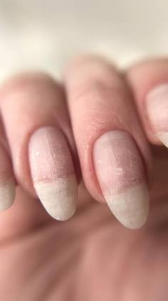 Nail Removal