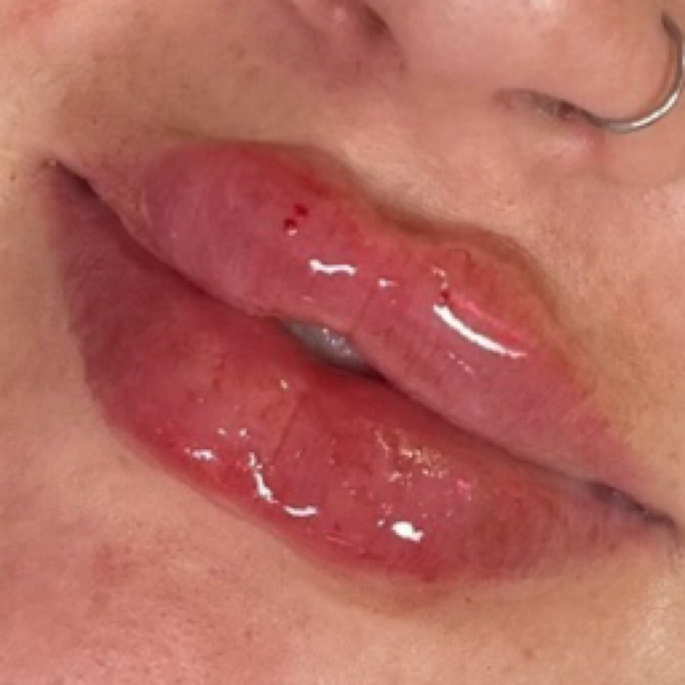 Ballerina Russian Lips at Glam X Sam MedBeauty in Andrews, TX
