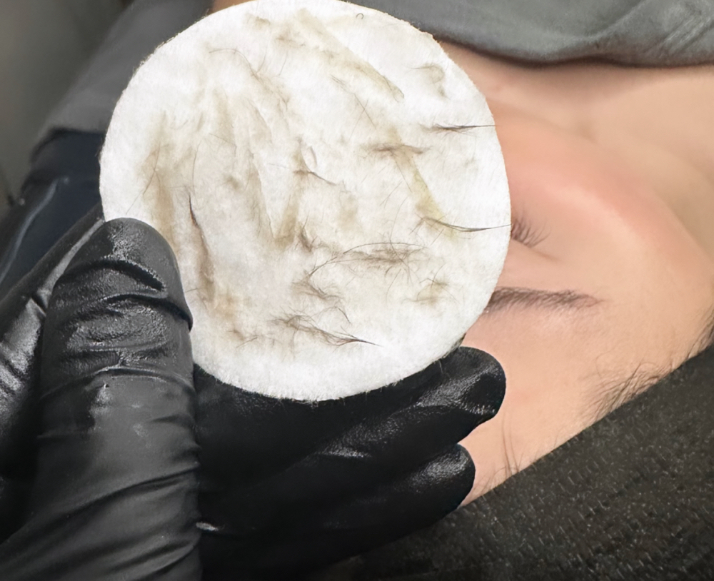 Glass Skin Dermaplane Facial