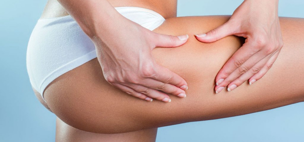 6 Sessions Cellulite Treatment