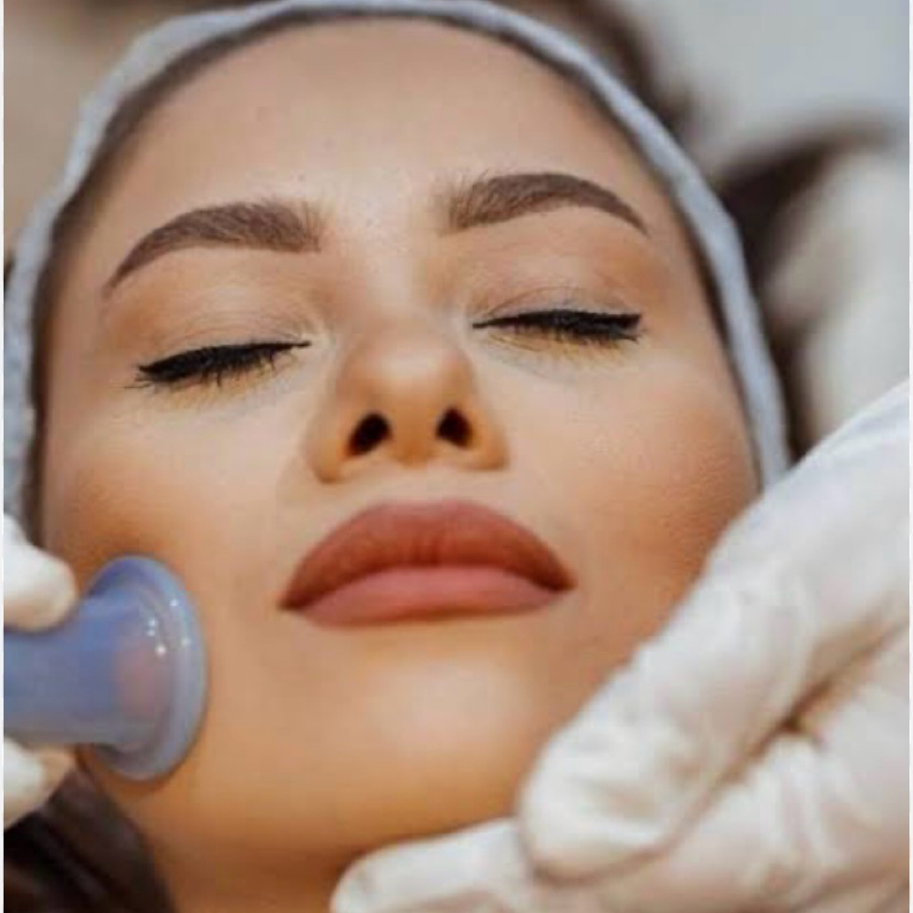Facial Cupping at Aquariusfacialspa in Matthews, NC