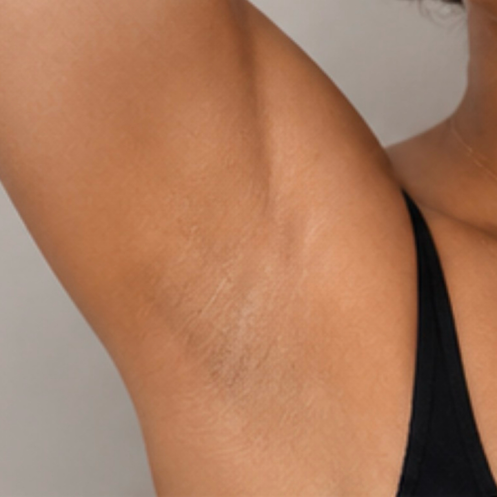 Add On Underarm Wax at Tranquil Touch By Lex LLC in Garner, NC