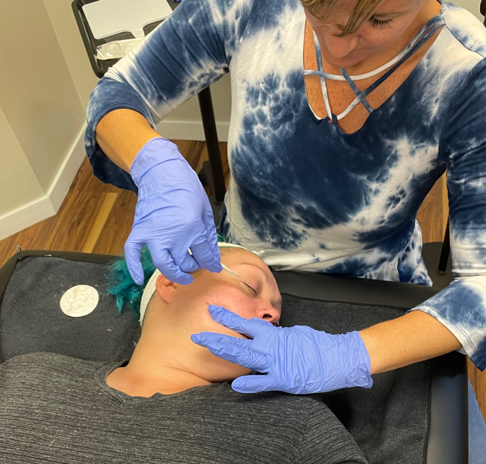Dermaplaning