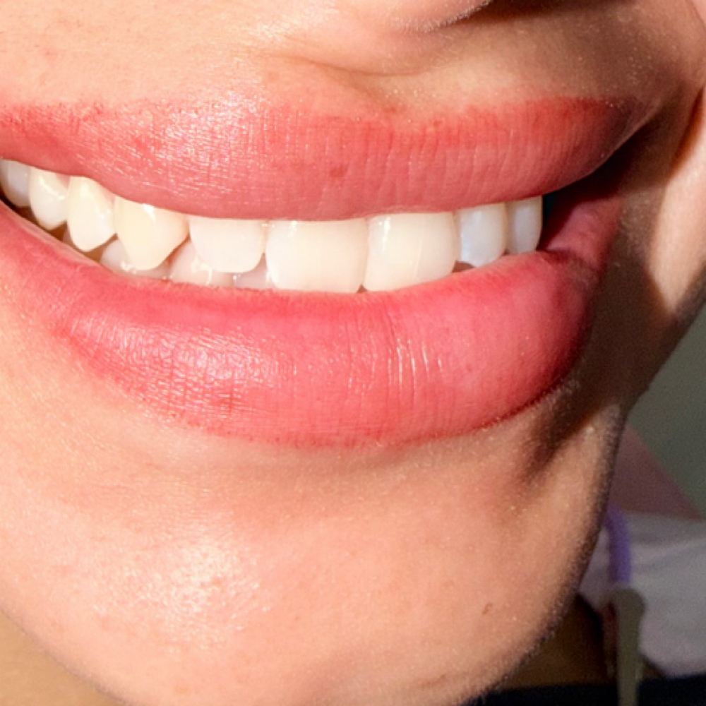 Bright Whitening at Yesenia’s Fit Glow in Richlands, NC