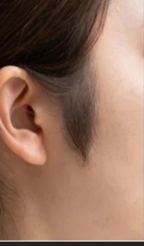 Sideburns