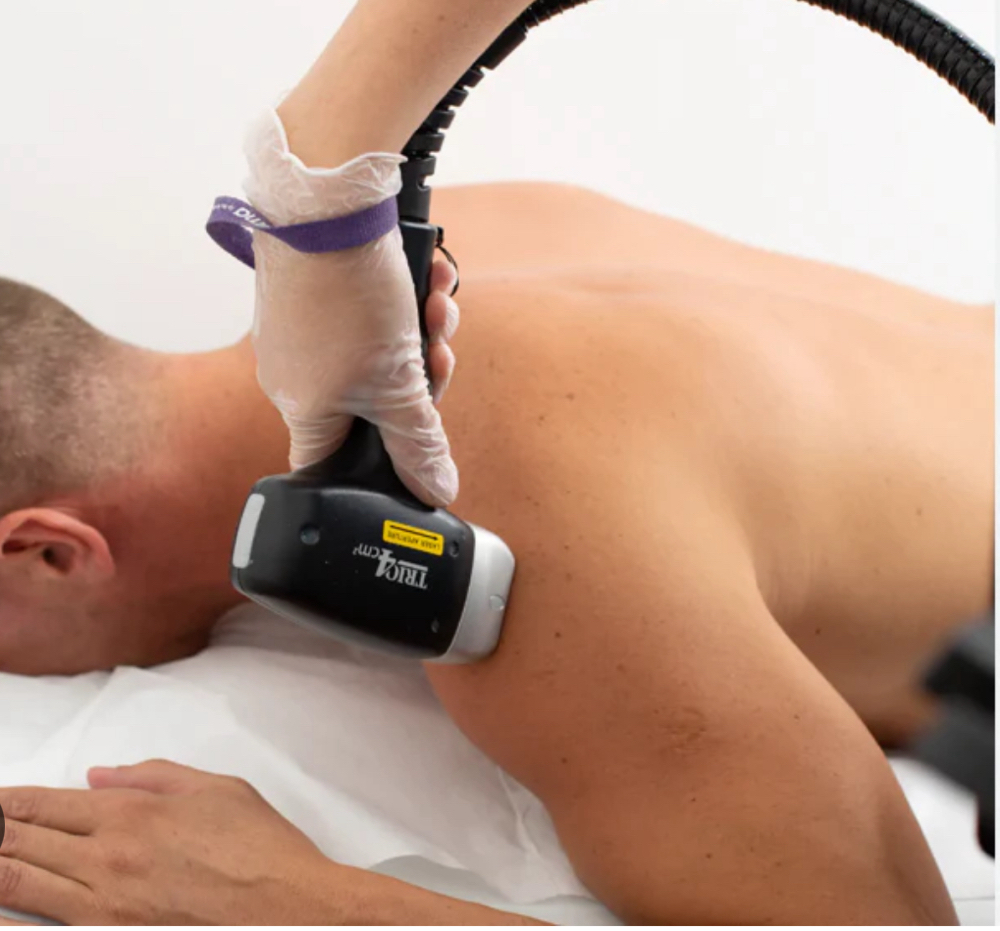 Shoulders (Men) - Laser Hair Remova