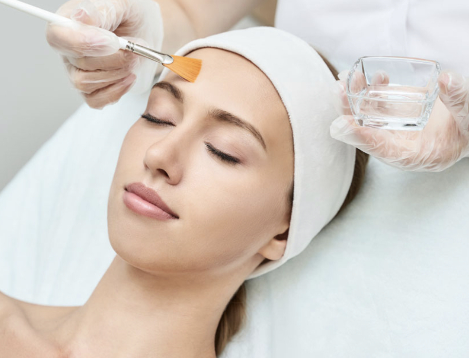 Chemical Peel