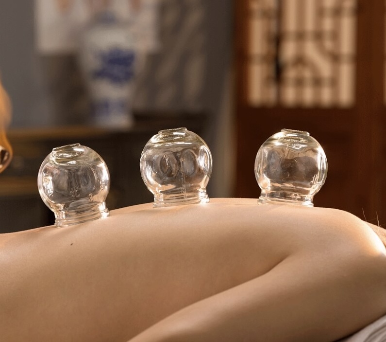 Cupping Massage