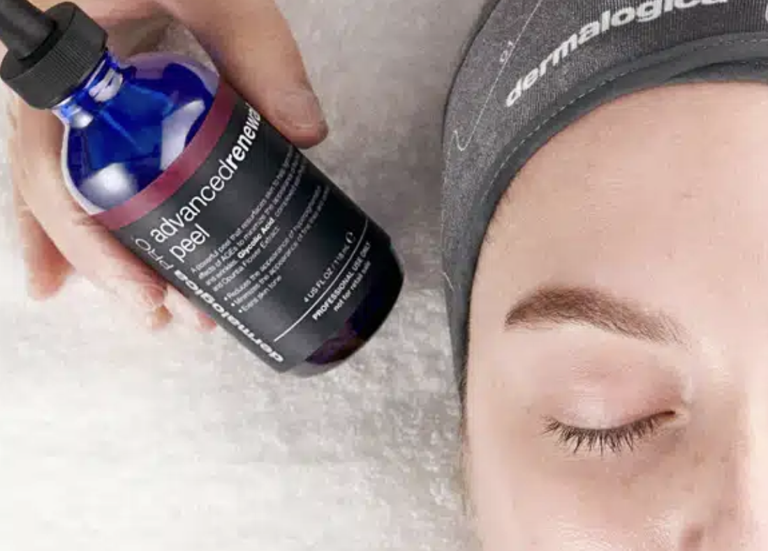 Customized Chemical Peel