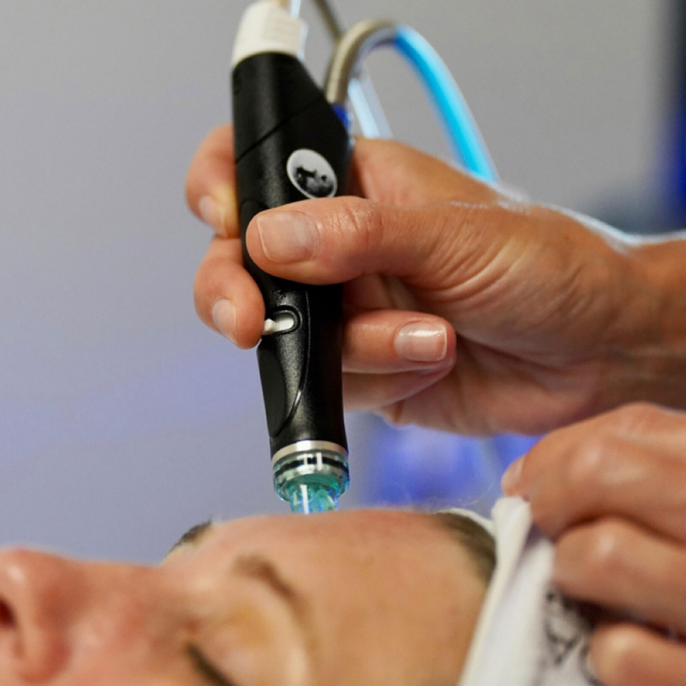 Express HydraFacial at The Ritual Aesthetics in Rocklin, CA