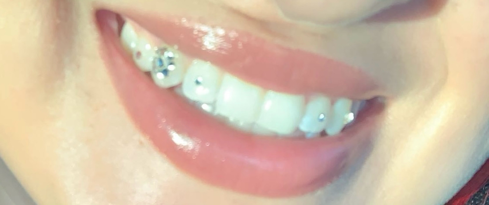 TOOTH GEMS ✨💎✨