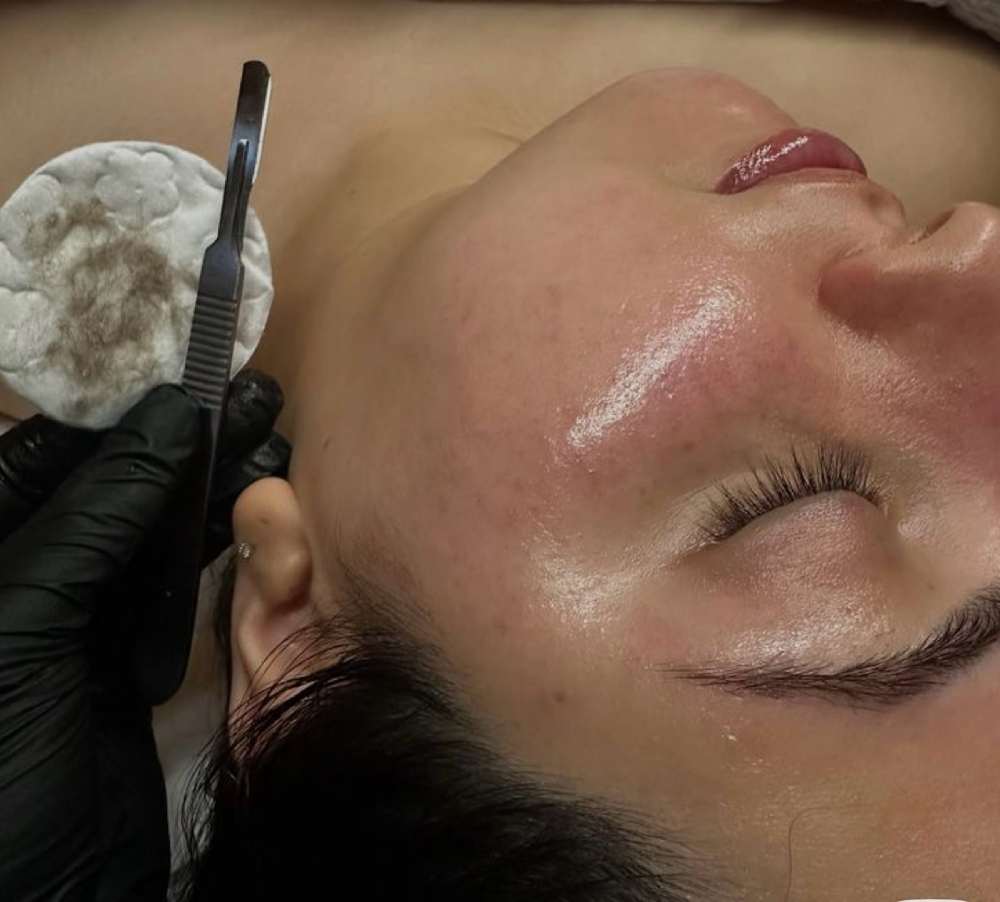 Dermaplaning  Glow Facial