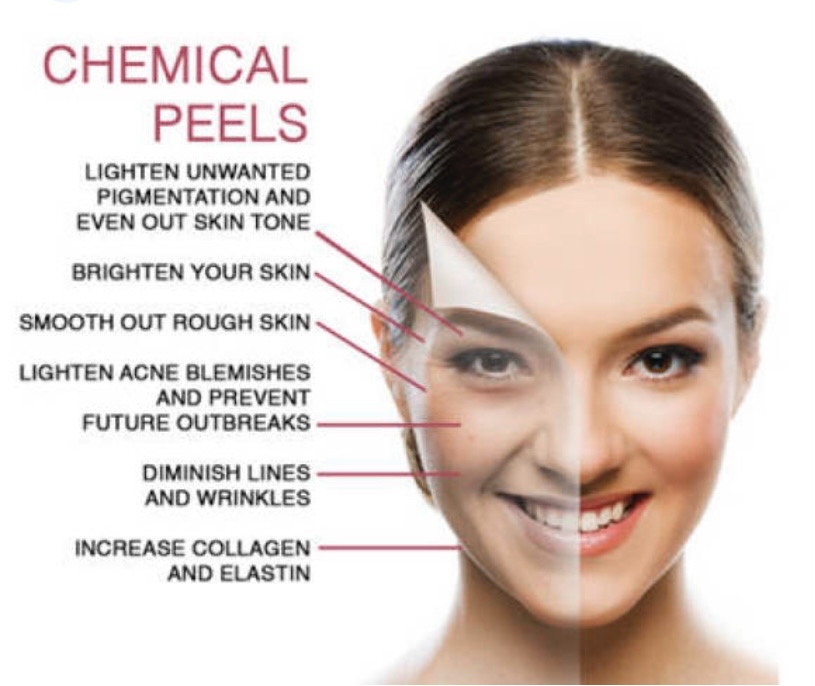 Skin Rejuvenation Chemical Peel