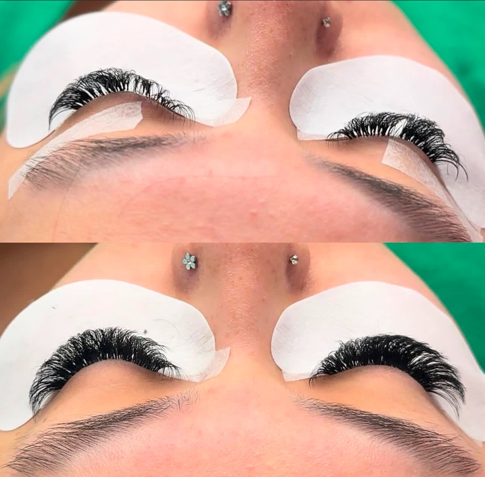 Volume Fill at ANAIZ GLAM in Baytown, TX