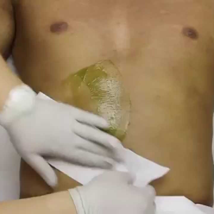 Chest & Stomach Waxing Combo at Facez By Monica in Lakewood, CA