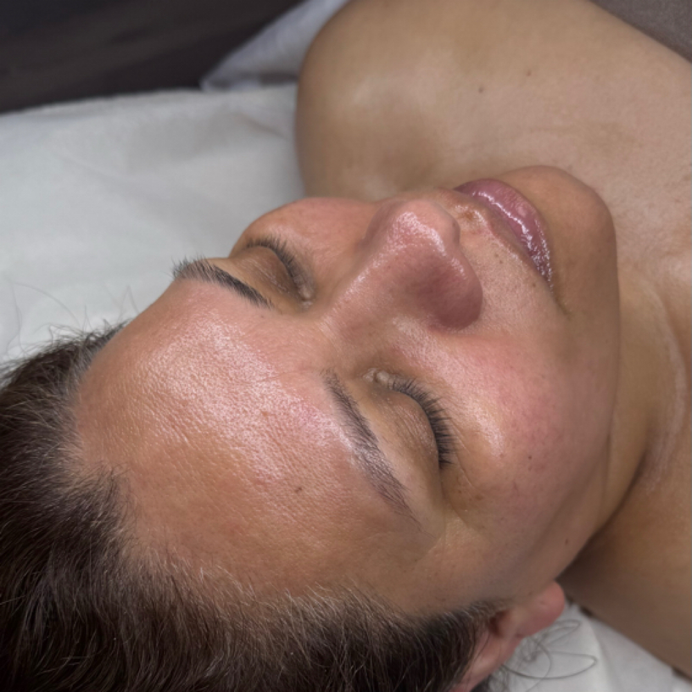 Facial Firming at Any Beauty Aesthetics Care in New York, NY