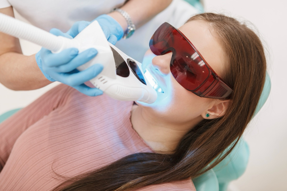 Teeth Whitening