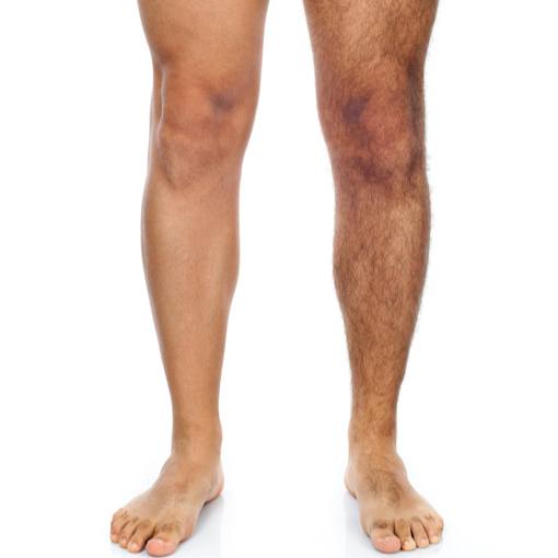 Full Legs For a Man