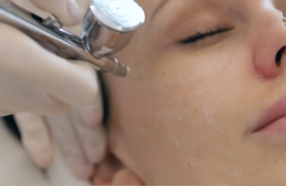 Oxygen Facial