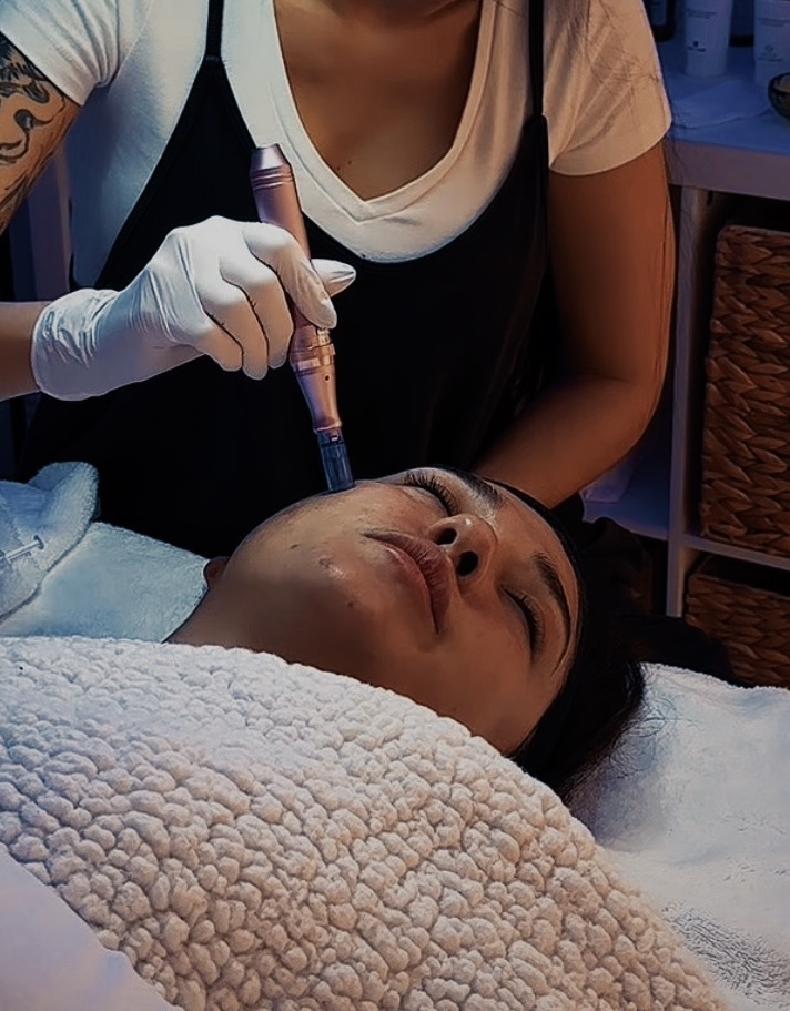 Microneedeling Facial at Pasha Hands in Coral Gables, FL