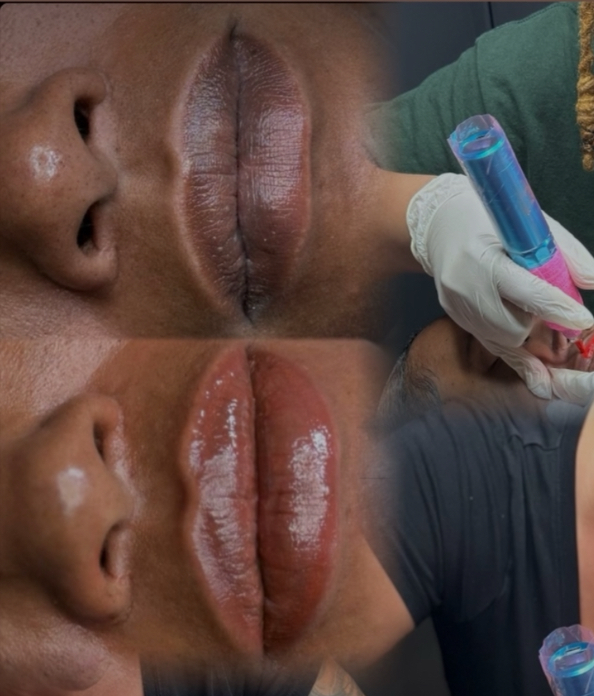 Lip Netraulization 6-8 WeekTouch Up