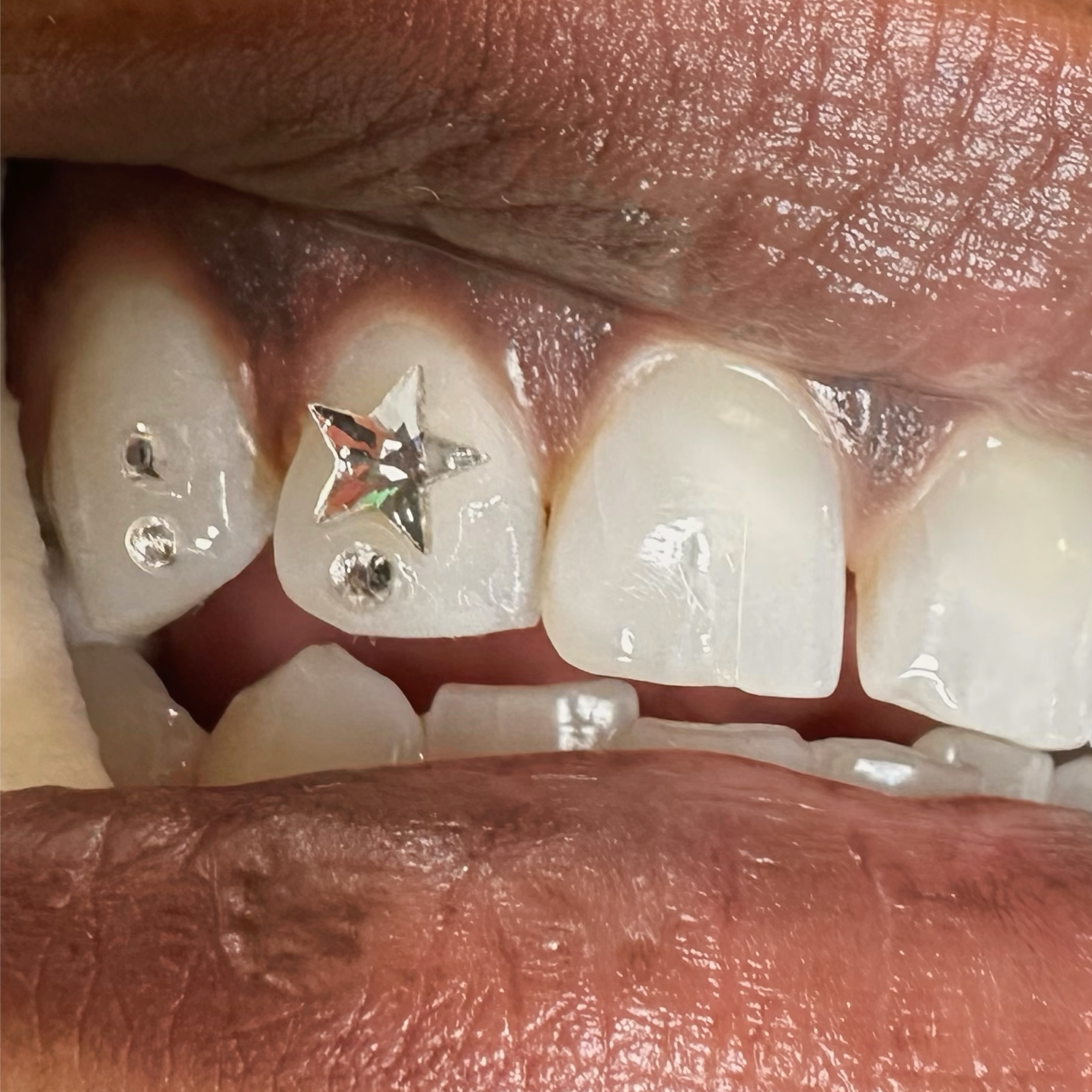 TOOTH GEMS at Atelier in Richmond, VA