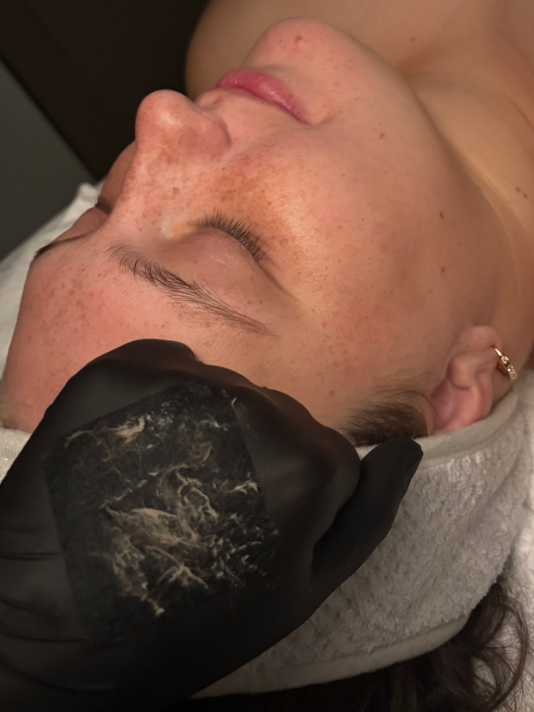 45 Minute Service-Dermaplane Option