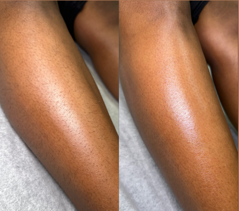 Lower Leg
