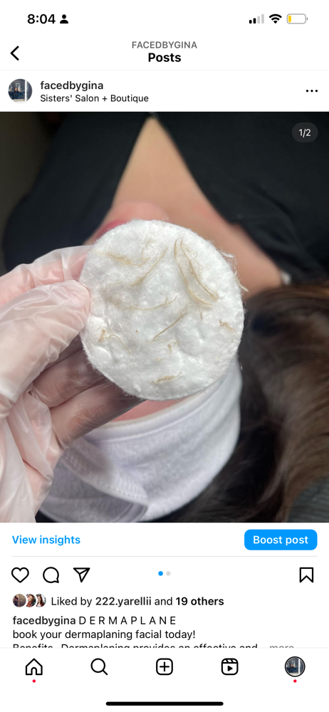 Dermaplane Facial